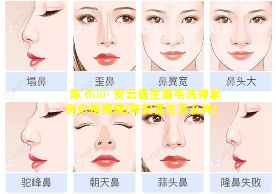 陈 🕷 安云医生眉毛洗掉案例价格揭晓(陈安医生怎么样)